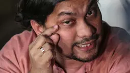 Penyanyi sekaligus dokter bedah, Tompi memberi keterangan terkait wajah bengkak Ratna Sarumpaet di Jakarta, Rabu (3/10). Tompi mengklarifikasi cuitannya di Twitter bahwa wajah bengkak Ratna bukan penganiayaan. (Liputan6.com/Faizal Fanani)