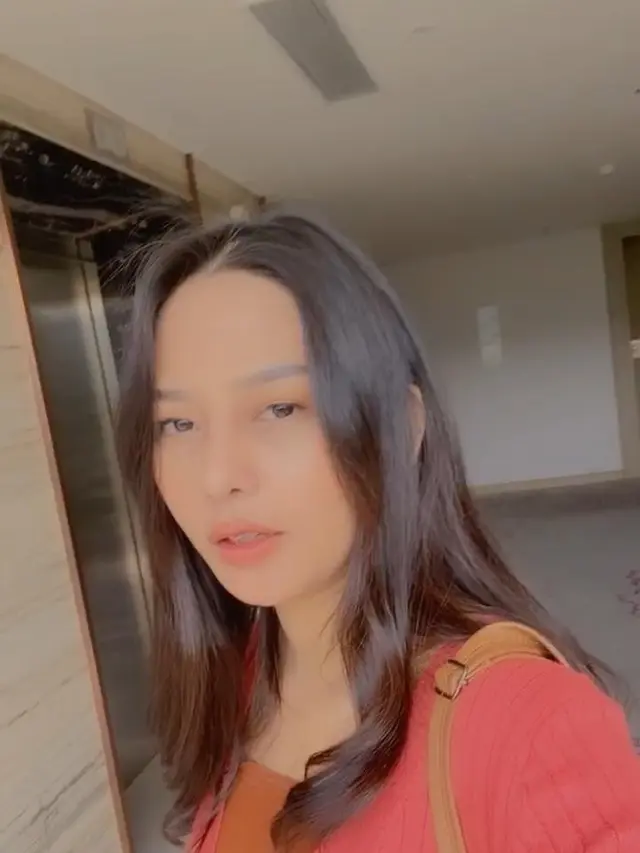 Potret Terbaru Dara Arafah setelah Operasi Rhinoplasty