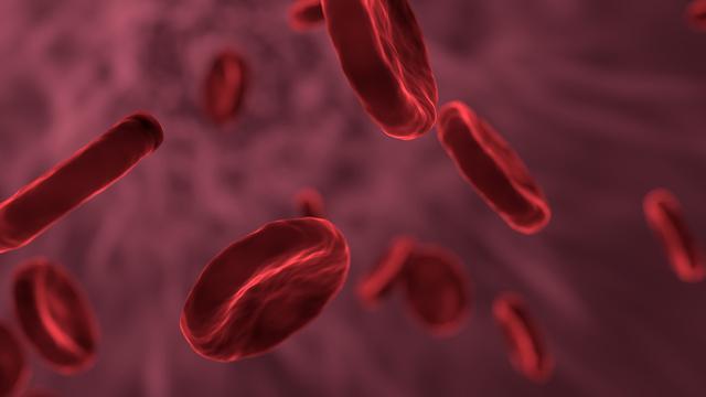 Penyebab Leukemia/pixabay