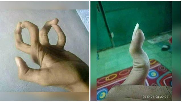 6 Potret Atraksi Jari Tangan Bikin Ngilu Saat Melihat Hot Liputan6 Com
