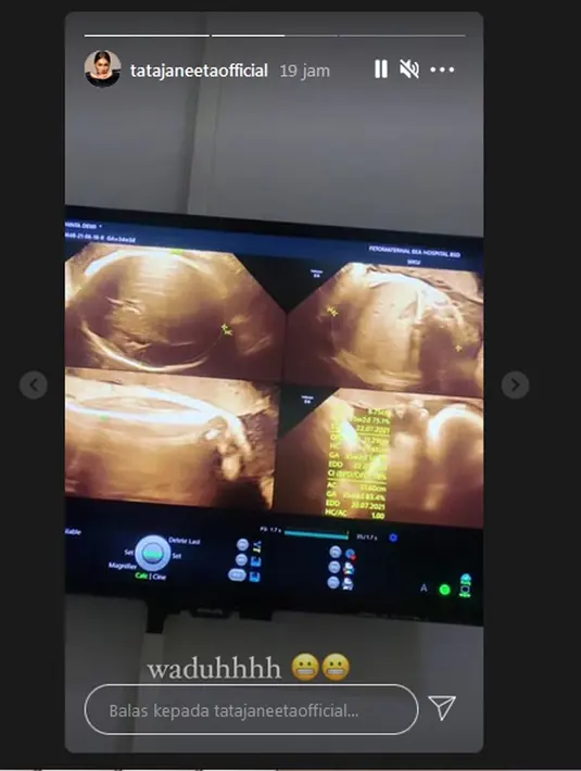 Tata Janeeta (Instagram/tatajaneetaofficial)