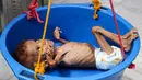 Seorang bocah yang menderita gizi buruk ditimbang di rumah sakit di Distrik Abs, Provinsi Haji, Yaman, Rabu (19/9). Konflik berkepanjangan antara pemerintah Yaman dengan pemberontak Houthi mengakibatkan 5,2 anak terancam kelaparan akut. (ESSA AHMED/AFP)