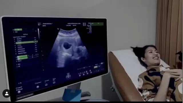 Melahirkan Anak Pertama, Ini 6 Perjalanan Kehamilan Istri Naga Eks Lyla