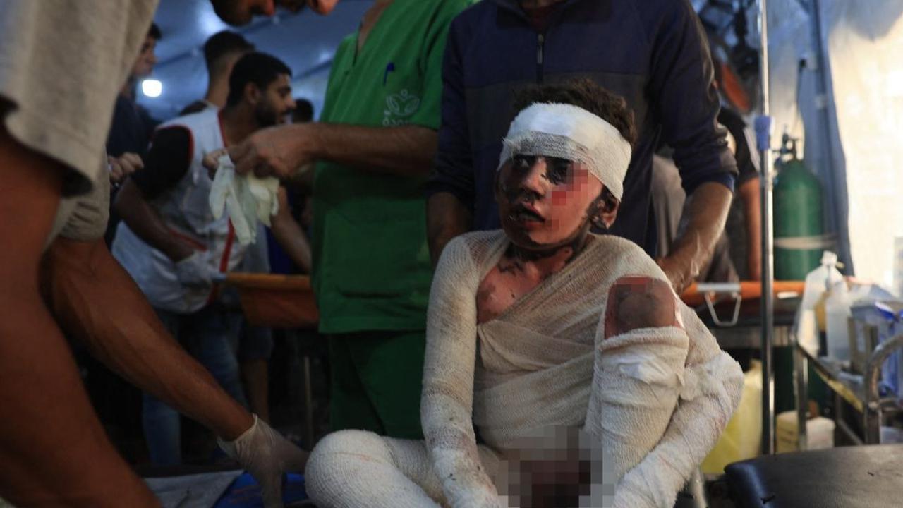 Seorang anak mendapatkan perawatan setelah terluka akibat serangan udara Israel di Sekolah Abu Oreiban yang dikelola PBB di Kamp Pengungsi Nuseirat, Jalur Gaza, Palestina, pada 14 Juli 2024. Serangan brutal Israel terhadap Sekolah Abu Oreiban yang difungs