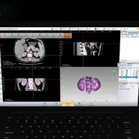 Teknologi 4.0 Berbasis 3D Print Terobosan Baru di Dunia Kesehatan