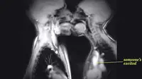 Foto: Adegan Video Seks via MRI Scanner (youtube.com)