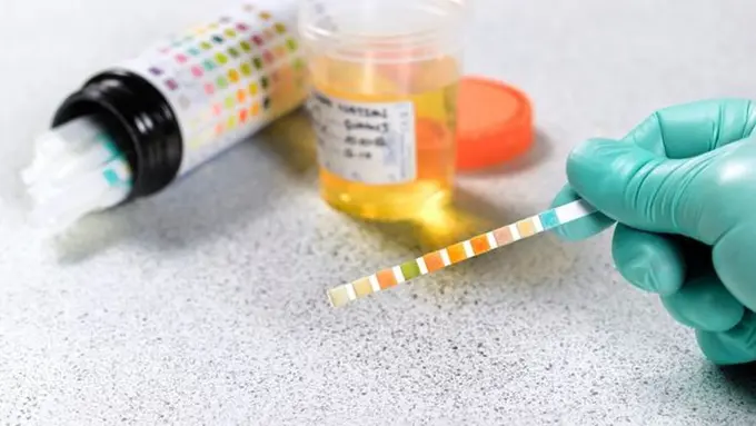 [Bintang] Tren Teraneh Abad Ini, Cuci Muka Pakai Air Kencing, Minat?