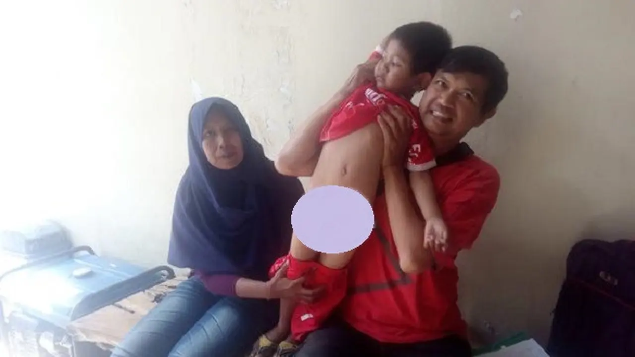 Hafidz, bocak asal Garut tanpa alat kelamin