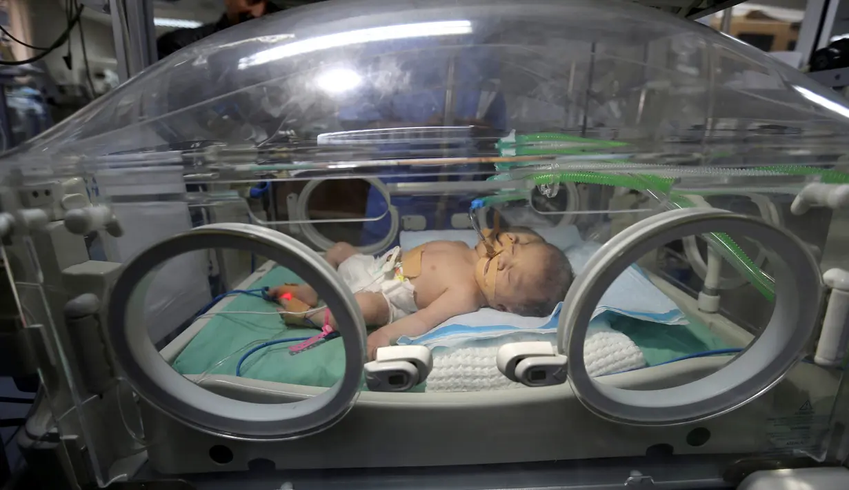 Kondisi bayi kembar siam yang tengah berjuang hidup di inkubator sehari setelah mereka lahir di RS Al Shifa, Kota Gaza, Rabu (23/11). Saat ini, belum jelas jenis kelamin dari bayi dengan hanya satu badan dan dua kepala itu. (REUTERS/Ibraheem Abu Mustafa)