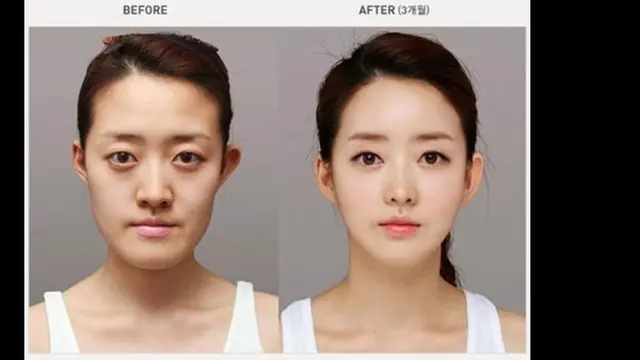 Foto: washingbrain.net