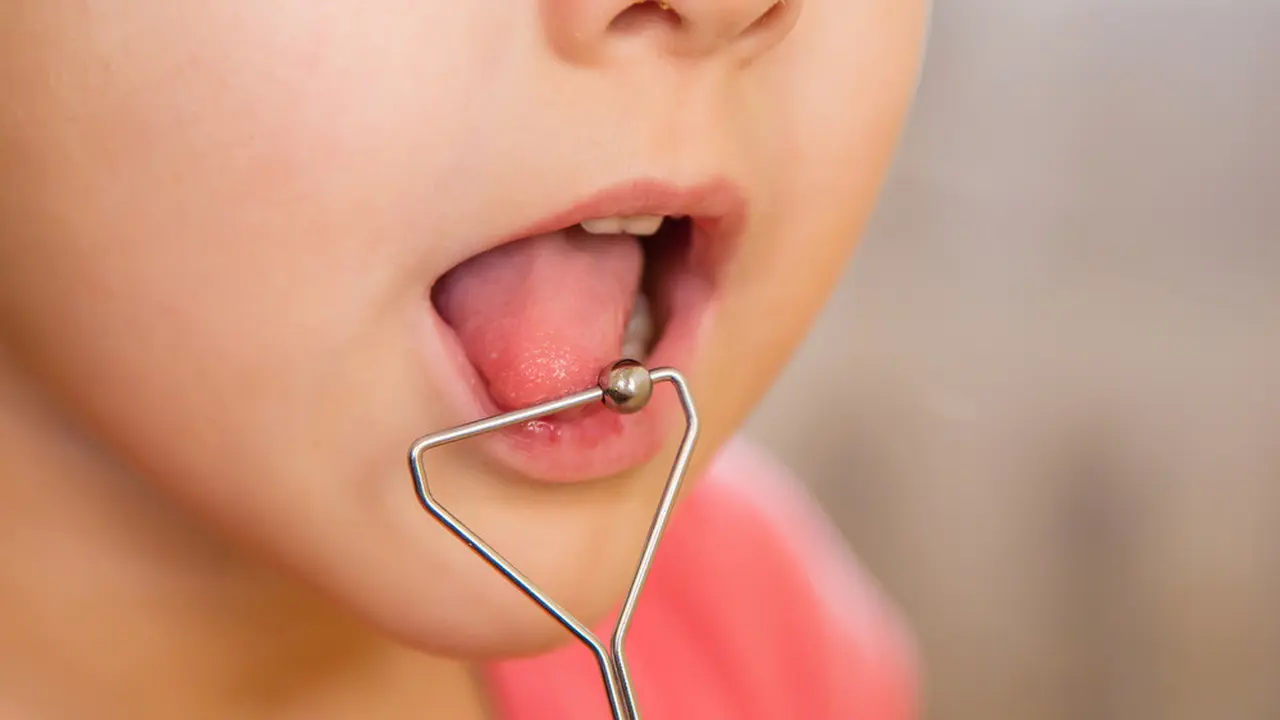 Si Kecil Masih Cadel? Ini Solusinya (Vitec/Shutterstock)