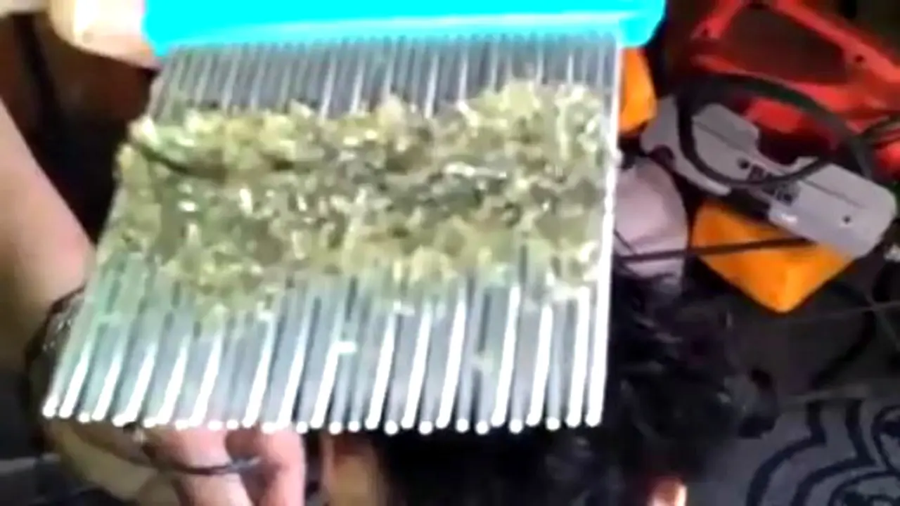 Waduh, Kutu Rambut Memenuhi Kepala Anak Ini 