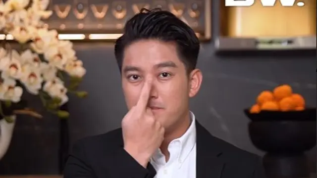 Boy William mengaku lakukan operasi hidung (Instagram/boywilliam17)