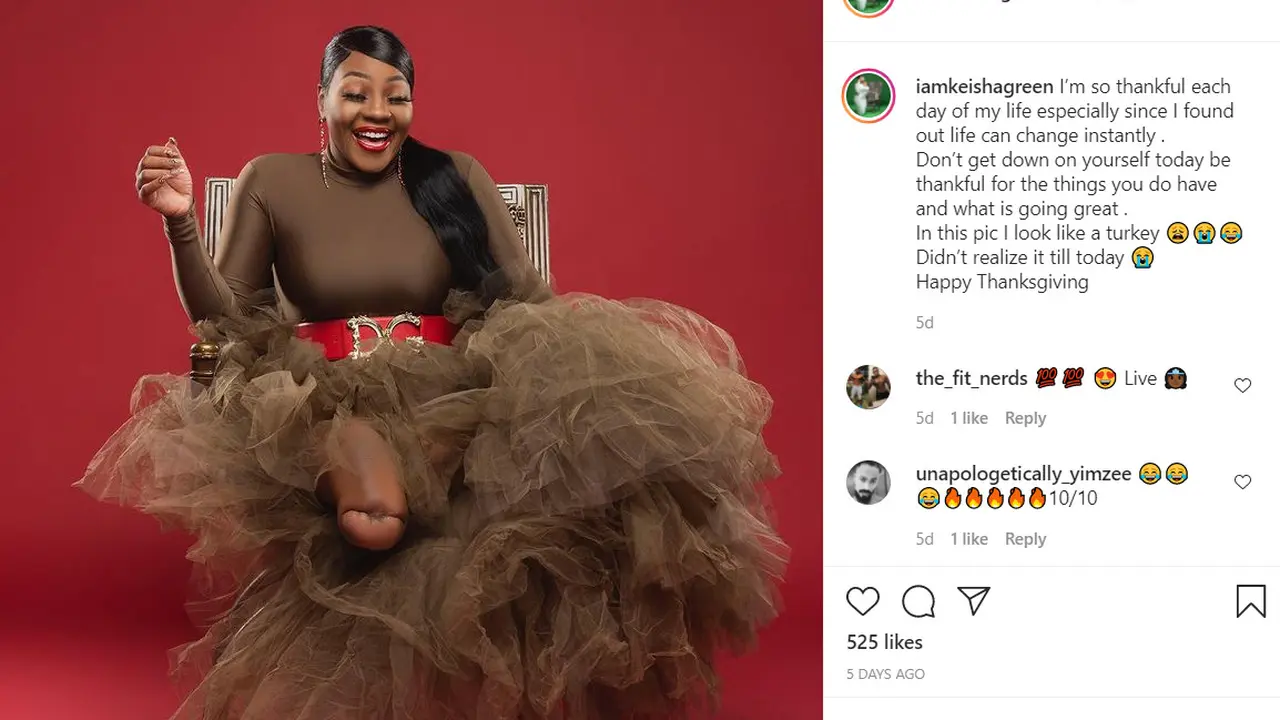 Keisha Green dengan kaki amputasi