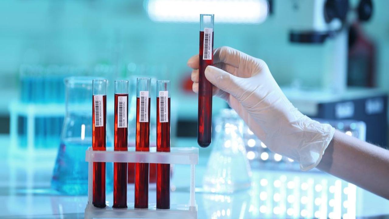 Mengenal Polycythemia Vera, Penyakit yang Menimpa Sri Suharyati<br>
