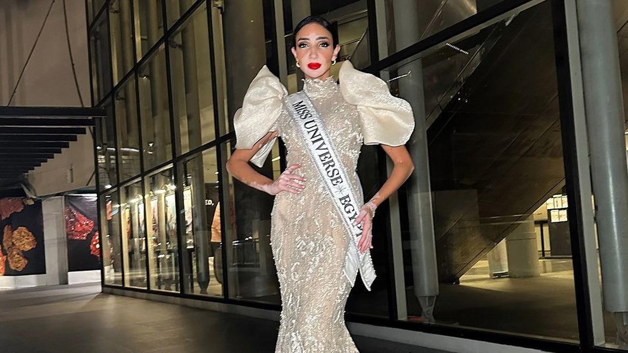 7 Potret Cantik dan Inspiratif Logina Salah, Peserta Miss Universe Pertama yang Mengidap Vitiligo