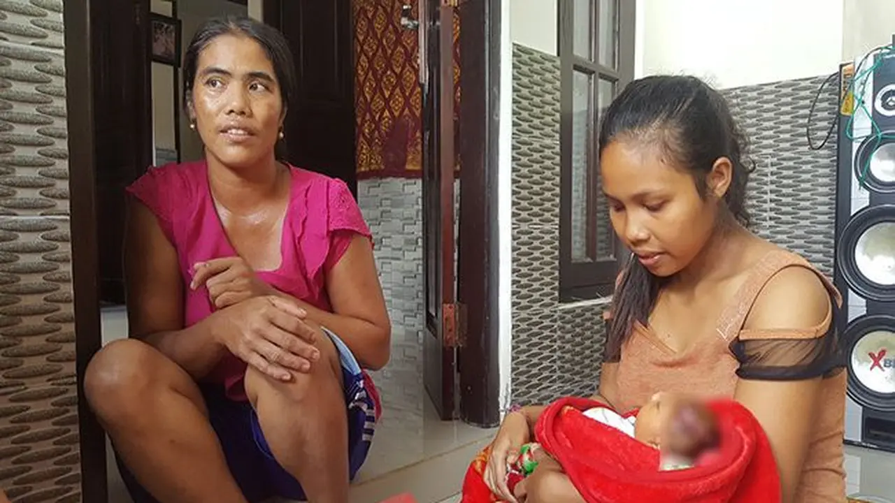 Bayi Tanpa Tempurung Kepala