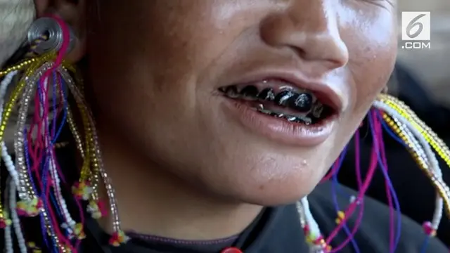 Simbol kecantikan di Desa Ann, Myanmar adalah gigi yang hitam. Oleh karena itu penduduknya yang berjenis kelamin wanita mengunyah daun sirih agar gigi mereka menghitam.
