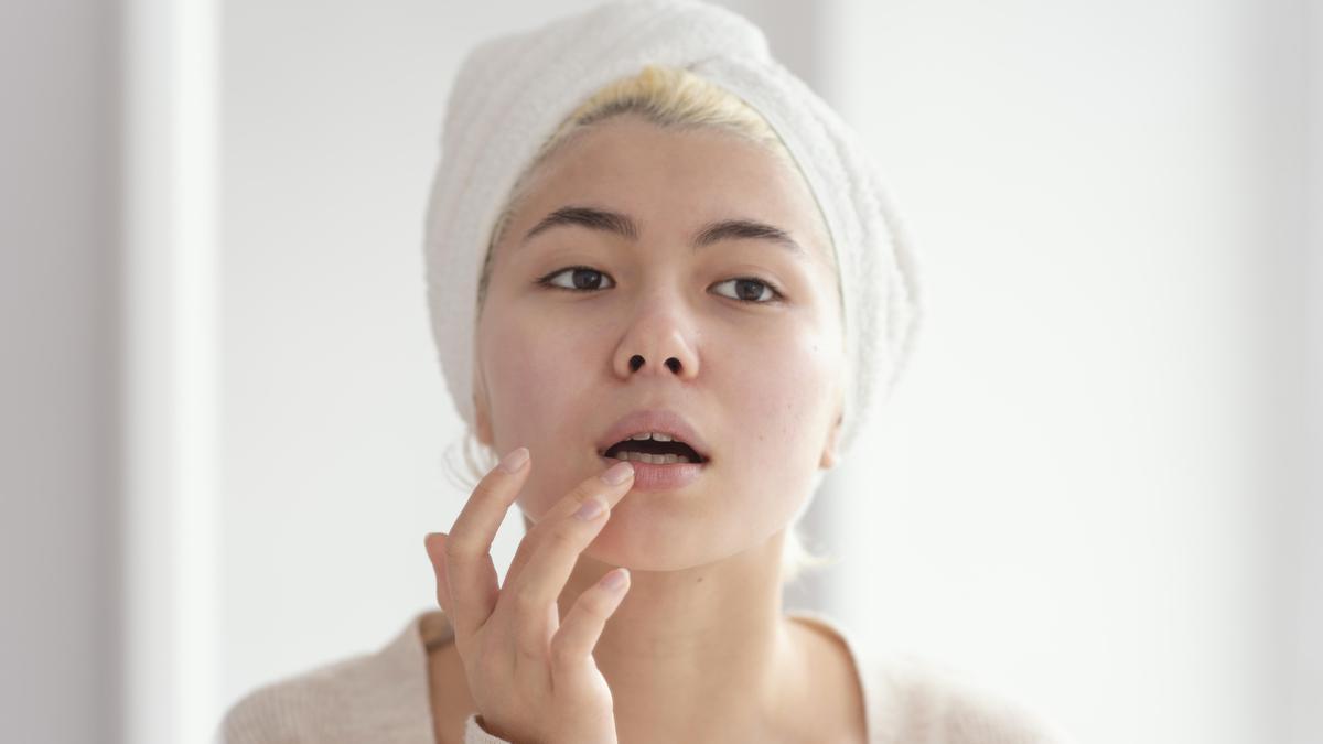 Peptide Lip Treatment, Tren Perawatan Bibir yang Makin Populer