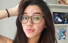 Intip Potret Terbaru Gabriella Ekaputri yang Menginspirasi untuk Mencintai Diri Sendiri