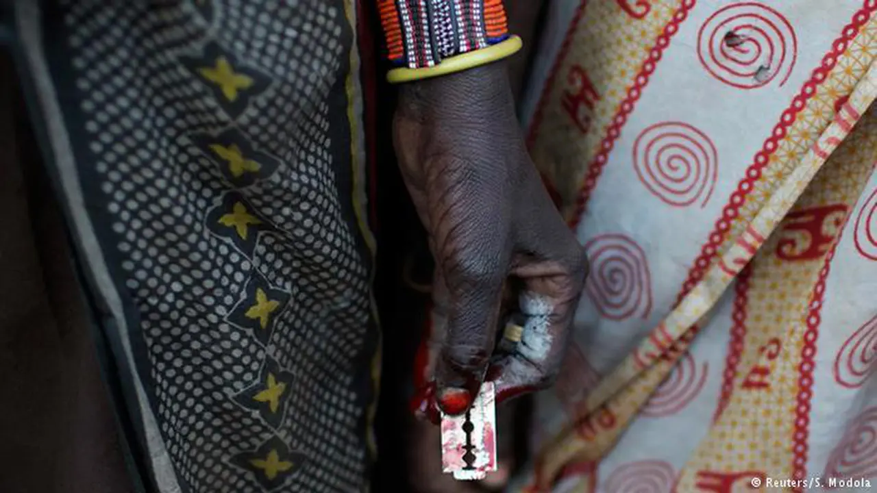 Alasan Afrika Mempertahankan Sunat Kaum Perempuan