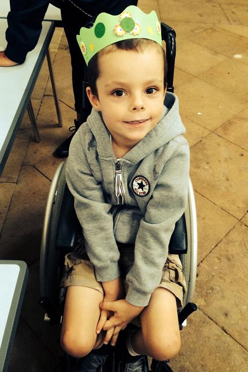 Alfie, bocah 7 tahun yang mengidap kondisi langka | Photo: Copyright mirror.co.uk