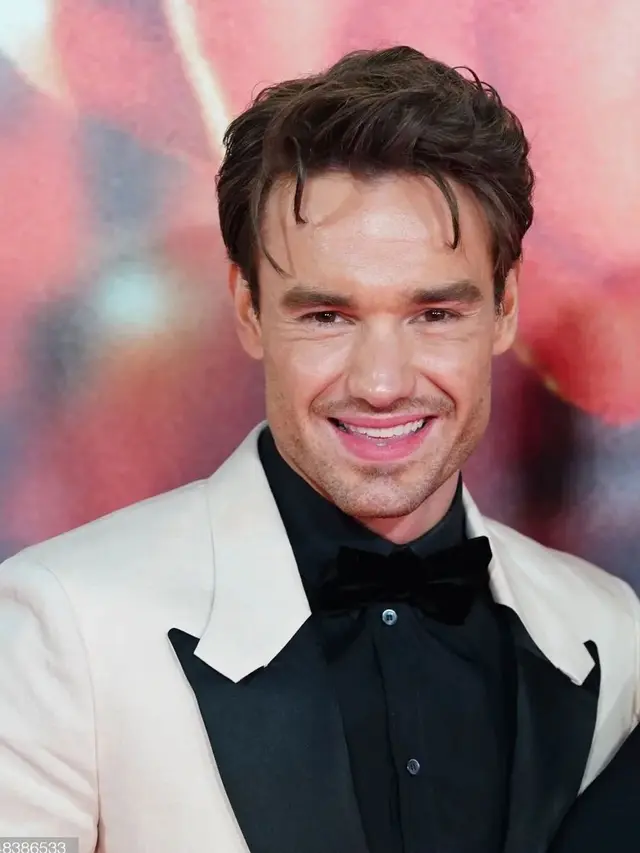 Liam Payne Tampil dengan Pipi Super Tirus, Diduga Jalani Operasi Pengangkatan Lemak