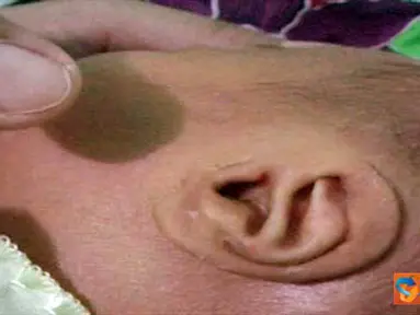 Tulisan Allah di Telinga Bayi