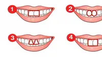 Kepribadian dari bentuk gigi. (Dok: Jagranjosh.com)