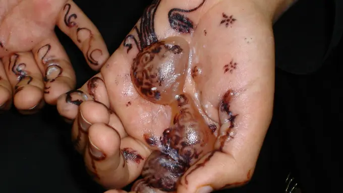 [Bintang] Bukannya Cantik, Hal Mengerikan Terjadi Usai Pakai Henna Hitam