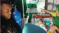 Bayi bermata satu di Mandailing Natal. (Liputan6.com/Reza Efendi)