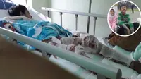 Kisah Helmi, Bocah 11 Tahun yang Ingin Bisa Berjalan Kembali