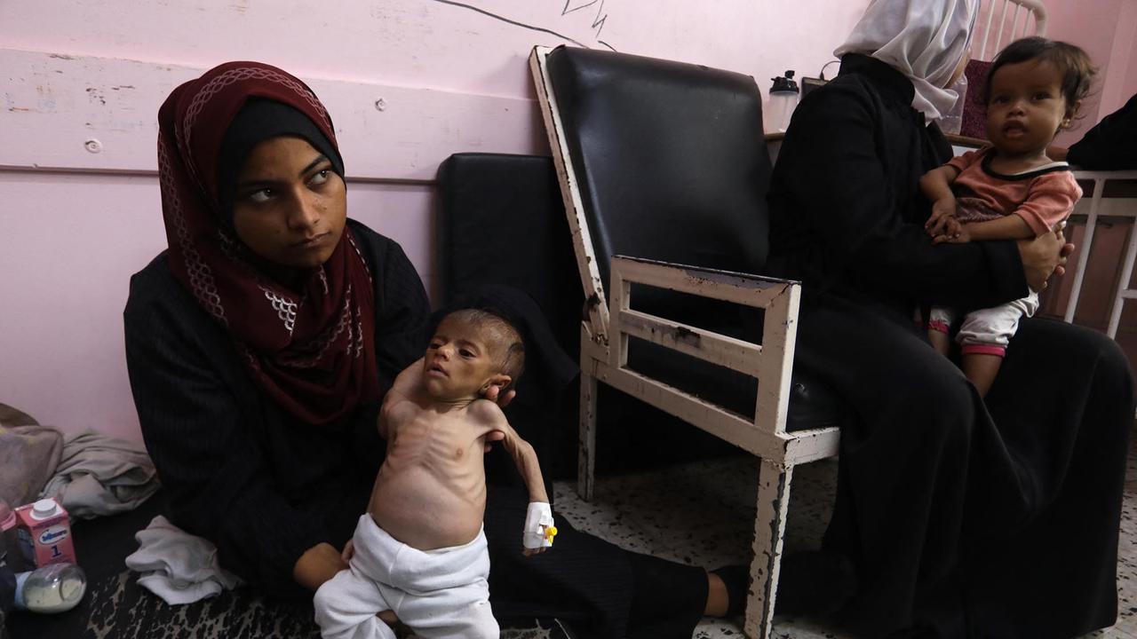 FOTO: Tubuh Kecil yang Lapar, Potret Pedih Bayi Gaza di Tengah Ancaman Kelaparan Massal