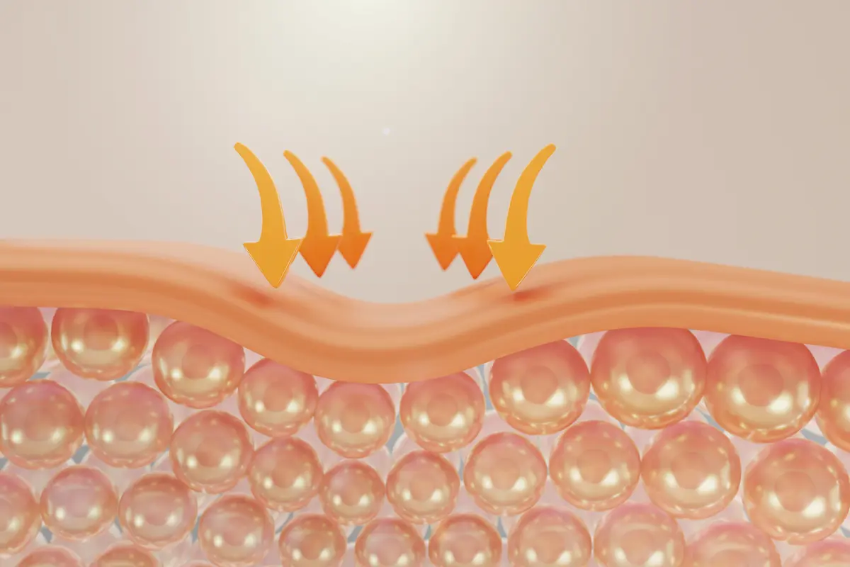 Skin barrier sebagai lapisan pelindung pertama pada kulit