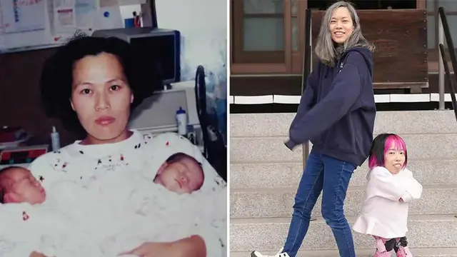Si Kembar Yoshie dan Michie Kikuchi Miliki Perbedaan Tinggi Badan 75 Sentimeter (Source: Guinness World Records)