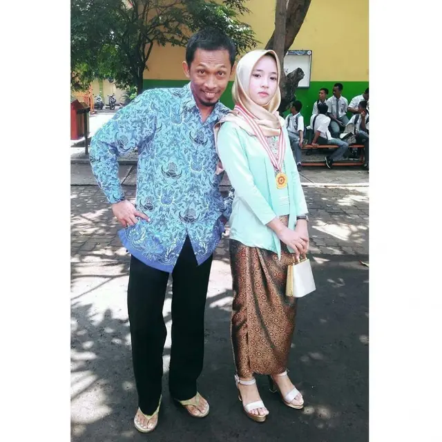 Unggah Foto Wajah Diperban dan Disebut Oplas, Ini 7 Potret Transformasi Nissa Sabyan