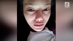 Wanita bernama Benyapa Supap mengalami iritasi pada kedua matanya setelah melakukan metode pemanjangan bulu mata. Diduga bahwa bulu mata palsu ditempel dengan lem super.