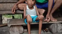 SN (4), salah satu anak penyandang disabilitas di Kecamatan Sekayu Kabupaten Musi Banyuasin Sumsel (Dok. Humas PPDI Musi Banyuasin / Nefri Inge)