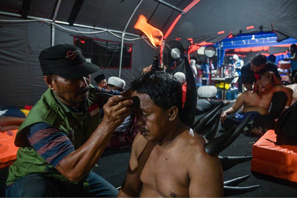 FOTO: Terapi Bekam Tanduk Sapi, Pilihan Lawas di Zaman Modern