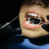 Berikut penyebab gigi berlubang pada anak./copyright pexels/cottonbro studio