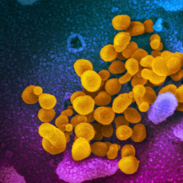 Ahli Virologi Sebut Mutasi Virus Corona Covid 19 Tak Secepat Hiv Dan Influenza Health Liputan6 Com