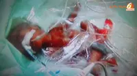 Bahagianya Keluarga Bayi Kembar Lima