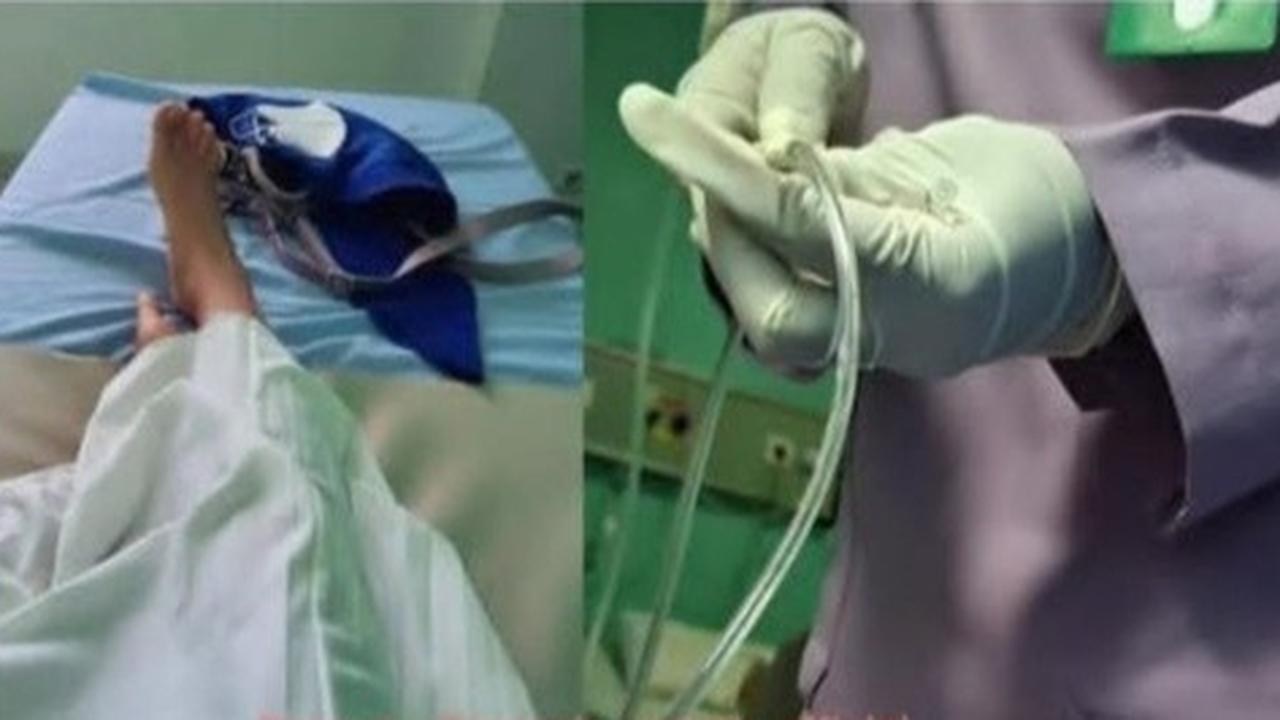 Viral Ibu di Pemalang Kena Tumor Otak Usai Suntik KB Jangka Panjang, Ini Penjelasan Dinkes Jateng