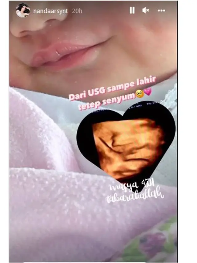 7 Momen Nanda Arsyinta Melahirkan Anak Pertama, Setia Didampingi Suami