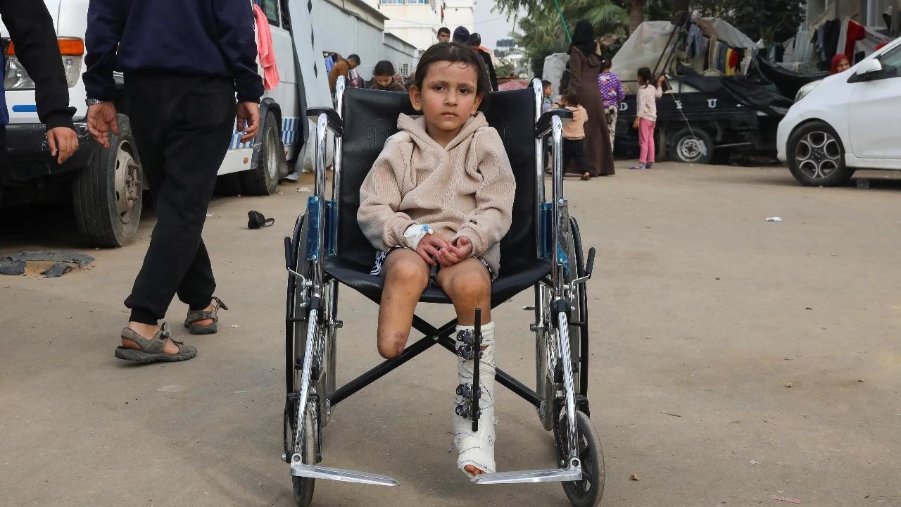 PBB Ungkap Fakta Menyedihkan: Satu dari Lima Orang yang Diamputasi di Gaza Adalah Anak-Anak