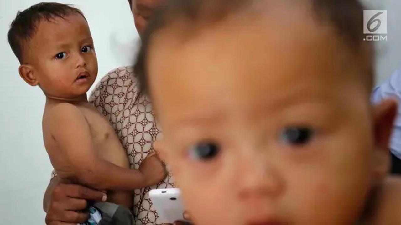 Gejala TBC pada Anak, Kenali Tanda dan Hal yang Perlu Orang Tua Lakukan
