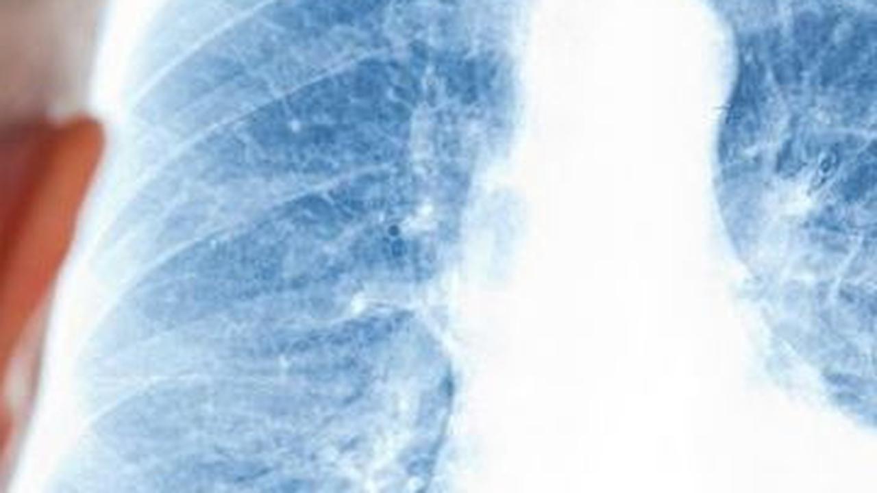 Mengonsumsi Minuman Beralkohol <br>