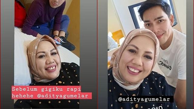 Beda Gaya Ely Sugigi Sebelum Vs Sesudah Potong Gigi (sumber: instagram/ellysugigi_real_)