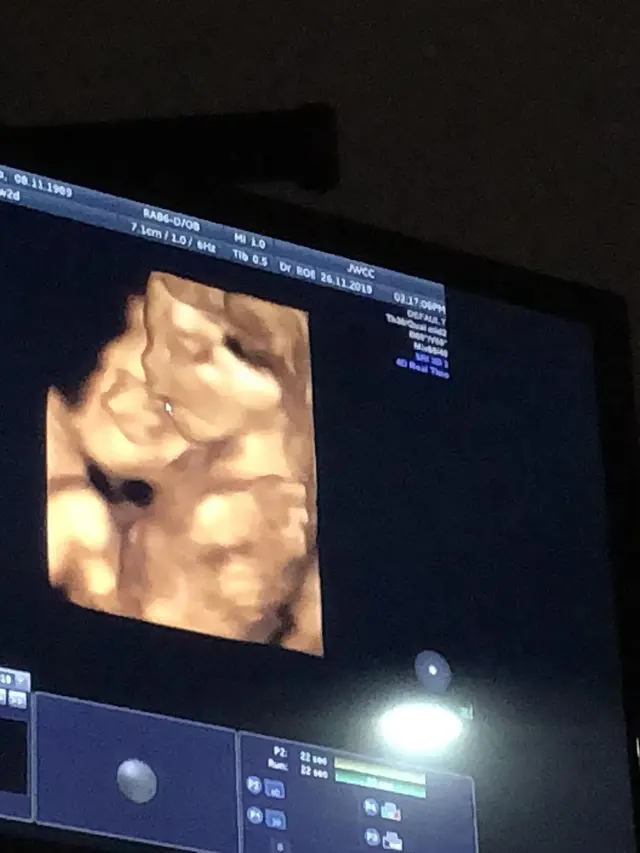 Chacha Frederica dan perjalanan hidupnya ( Instagram/chafrederica)