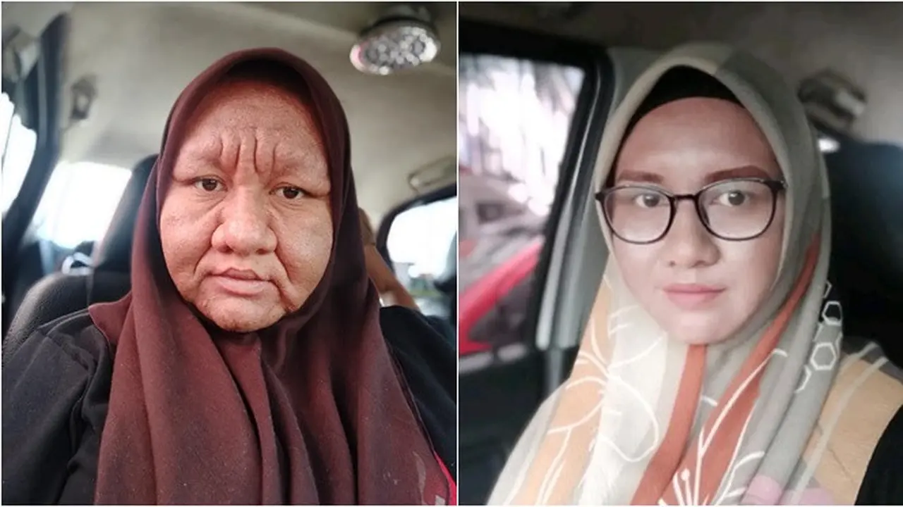 Viral, Wanita Ini Alami Perubahan Wajah Seperti Nenek-nenek Saat Hamil